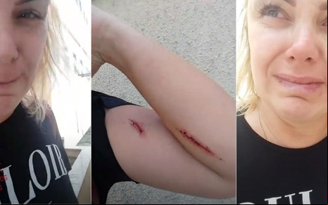 Ana Paula Almeida, a Pituxita, chora em vídeo ao falar das agressões físicas do marido - REPRODUÇÃO/INSTAGRAM